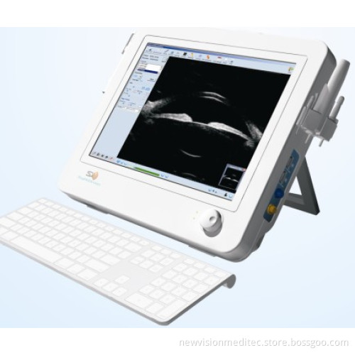 Ultrasound Biomicroscope (UBM)